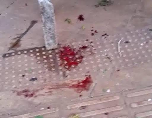 Pessoa fica gravemente ferida após briga de facão e cinta em Giruá