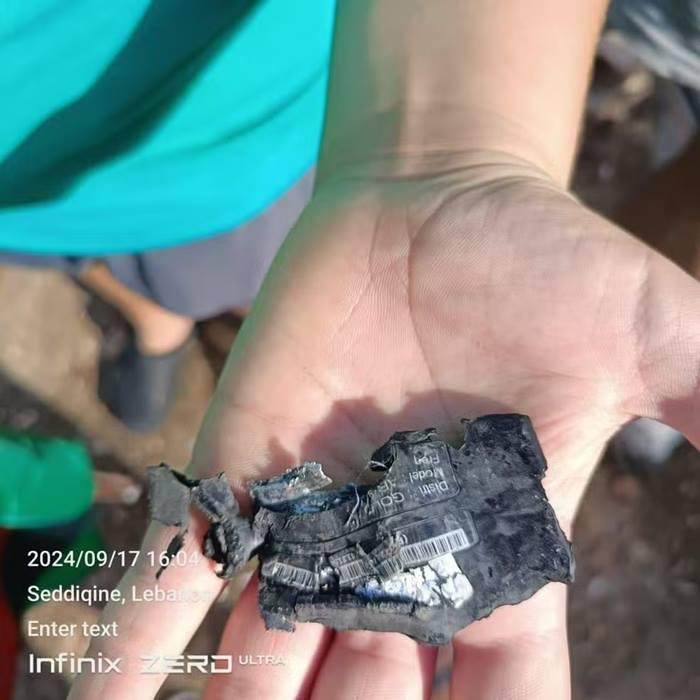 Explosão de pagers deixa centenas de integrantes do Hezbollah feridos no Líbano