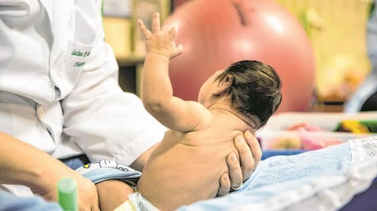 Lula veta pensão para crianças com microcefalia