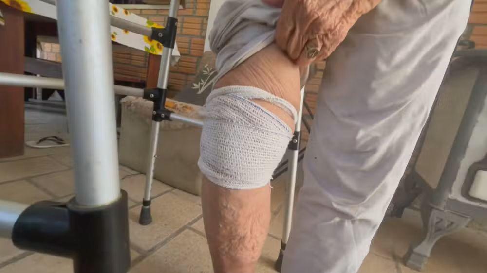 Fila por consultas e cirurgias no RS continua alta apesar de programas de redução