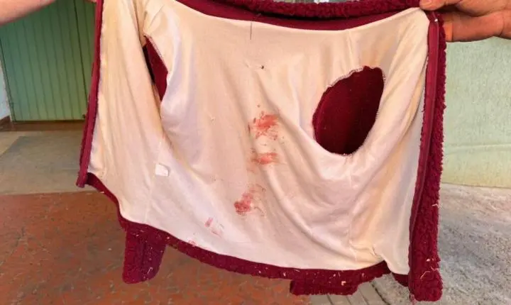 Mulher é baleada em reserva indígena de Erebango em meio a conflito